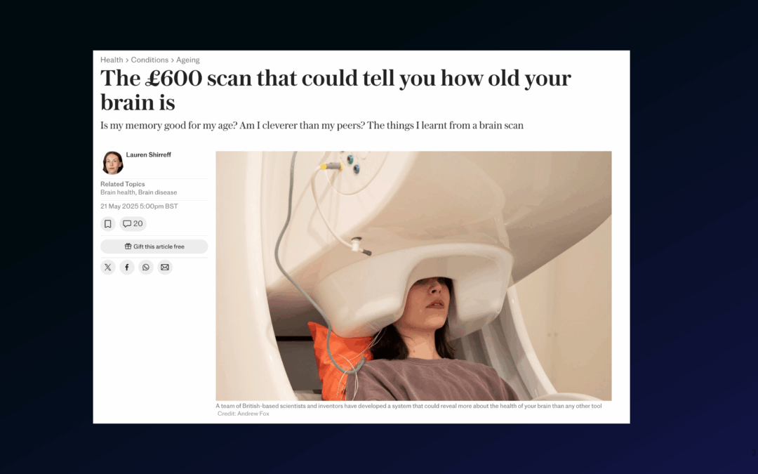 The £600 scan that could tell you how old your brain is